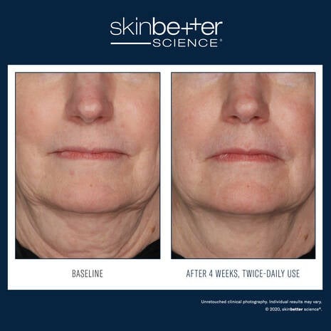 InterFuse Treatment Cream FACE & NECK 30ml