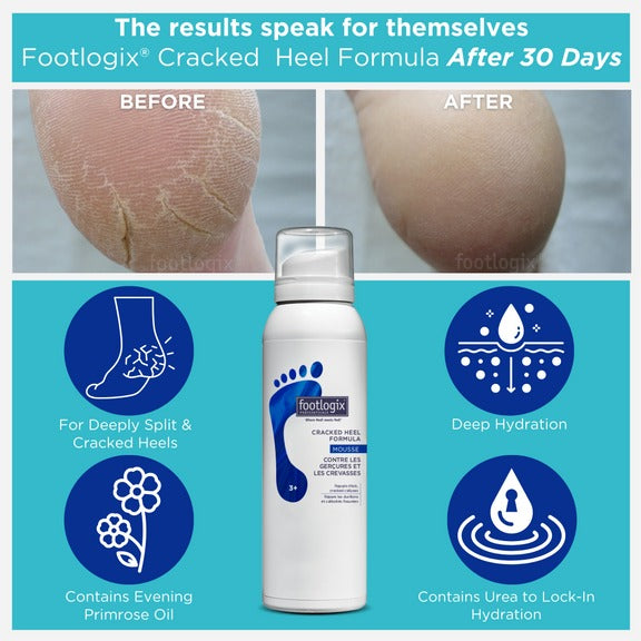 Footlogix Cracked Heel Formula